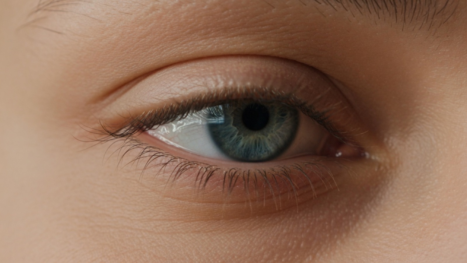 Close-up of an eye whose upper lid has not fully met the lower lid.