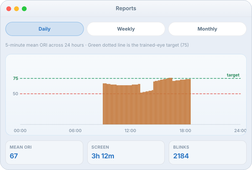 EyesRhythm daily ORI report chart with weekly and monthly tabs